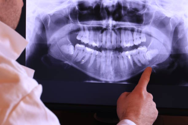 Best Emergency Gum Treatment in Dover Beaches North, NJ